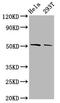 Zinc finger protein PLAGL2 antibody, LS-C681062, Lifespan Biosciences, Western Blot image 