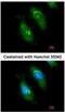 Survival Of Motor Neuron 2, Centromeric antibody, NBP1-32021, Novus Biologicals, Immunofluorescence image 