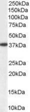 Alcohol dehydrogenase [NADP+] antibody, GTX11802, GeneTex, Western Blot image 