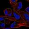 ALK Receptor Tyrosine Kinase antibody, HPA010694, Atlas Antibodies, Immunofluorescence image 