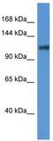 Anoctamin-6 antibody, TA336048, Origene, Western Blot image 