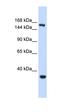 Eukaryotic Translation Initiation Factor 4 Gamma 3 antibody, orb324867, Biorbyt, Western Blot image 