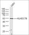 Interleukin 1 Receptor Associated Kinase 1 Binding Protein 1 antibody, orb184377, Biorbyt, Western Blot image 