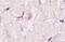 Seprase antibody, MBS240133, MyBioSource, Immunohistochemistry frozen image 