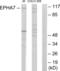 EPH Receptor A7 antibody, abx013620, Abbexa, Western Blot image 