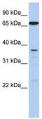 ATP Binding Cassette Subfamily B Member 9 antibody, TA331839, Origene, Western Blot image 