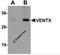 Homeobox protein VENTX antibody, 5863, ProSci Inc, Western Blot image 