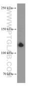 Integrin Subunit Alpha 2b antibody, 60350-1-Ig, Proteintech Group, Western Blot image 