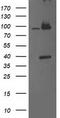 Proteasome 26S Subunit, Non-ATPase 2 antibody, TA503218S, Origene, Western Blot image 