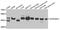 CHRNA7-FAM7A fusion protein antibody, A11856, Boster Biological Technology, Western Blot image 