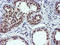Ubiquitin carboxyl-terminal hydrolase 7 antibody, LS-C173563, Lifespan Biosciences, Immunohistochemistry frozen image 
