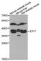 ETV7 antibody, MBS9126108, MyBioSource, Western Blot image 