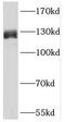 SURP And G-Patch Domain Containing 2 antibody, FNab07788, FineTest, Western Blot image 