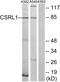 Vomeronasal 2 Receptor 1 pseudogene antibody, PA5-39614, Invitrogen Antibodies, Western Blot image 
