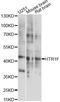 5-Hydroxytryptamine Receptor 1F antibody, LS-C749724, Lifespan Biosciences, Western Blot image 