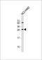 Fibroblast growth factor 18 antibody, GTX81796, GeneTex, Western Blot image 