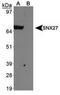 Sorting nexin-27 antibody, TA309874, Origene, Western Blot image 