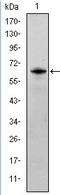 FYN Proto-Oncogene, Src Family Tyrosine Kinase antibody, AM06641SU-N, Origene, Western Blot image 