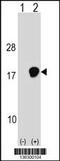 Ubiquitin Conjugating Enzyme E2 D3 antibody, 58-731, ProSci, Western Blot image 