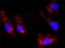 Diacylglycerol kinase alpha antibody, H00001606-M02, Novus Biologicals, Proximity Ligation Assay image 