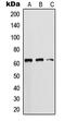 Keratin 5 antibody, MBS822090, MyBioSource, Western Blot image 