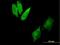 Cytoplasmic dynein 1 intermediate chain 2 antibody, H00001781-B01P, Novus Biologicals, Immunofluorescence image 