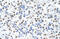 Musashi RNA Binding Protein 2 antibody, ARP41112_T100, Aviva Systems Biology, Immunohistochemistry paraffin image 