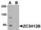 Zinc Finger CCCH-Type Containing 12B antibody, TA306954, Origene, Western Blot image 