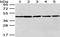 Vacuolar Protein Sorting 4 Homolog A antibody, TA351917, Origene, Western Blot image 