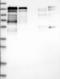 Nuclear Receptor Coactivator 7 antibody, NBP1-85200, Novus Biologicals, Western Blot image 