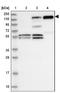 1-phosphatidylinositol-4,5-bisphosphate phosphodiesterase beta-1 antibody, NBP2-38220, Novus Biologicals, Western Blot image 