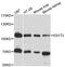 Extended Synaptotagmin 2 antibody, LS-C747901, Lifespan Biosciences, Western Blot image 