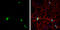 ELAV Like RNA Binding Protein 3 antibody, GTX134128, GeneTex, Immunocytochemistry image 