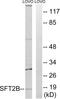 SFT2 Domain Containing 2 antibody, abx014997, Abbexa, Western Blot image 