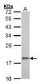 Ribosomal Protein S10 antibody, LS-C185436, Lifespan Biosciences, Western Blot image 