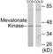 Mevalonate Kinase antibody, EKC1772, Boster Biological Technology, Western Blot image 