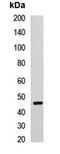 CCNE2 antibody, LS-C668698, Lifespan Biosciences, Western Blot image 
