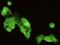E3 ubiquitin-protein ligase CHIP antibody, GTX02047, GeneTex, Immunocytochemistry image 