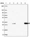 Deoxycytidine Kinase antibody, NBP2-38972, Novus Biologicals, Western Blot image 