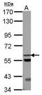 Acyl-coenzyme A thioesterase 12 antibody, PA5-32152, Invitrogen Antibodies, Western Blot image 