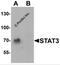 STAT3 antibody, 7197, ProSci Inc, Western Blot image 