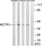 Natural Cytotoxicity Triggering Receptor 1 antibody, TA314908, Origene, Western Blot image 