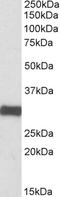 Electron transfer flavoprotein subunit alpha, mitochondrial antibody, EB10174, Everest Biotech, Western Blot image 
