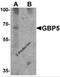 Guanylate Binding Protein 5 antibody, 7327, ProSci Inc, Western Blot image 