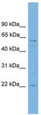 FTO Alpha-Ketoglutarate Dependent Dioxygenase antibody, TA342385, Origene, Western Blot image 