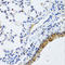Matrix Metallopeptidase 19 antibody, LS-C334857, Lifespan Biosciences, Immunohistochemistry frozen image 