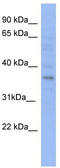 Vesicle Trafficking 1 antibody, TA345019, Origene, Western Blot image 