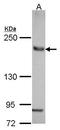 AE 2 antibody, GTX114768, GeneTex, Western Blot image 