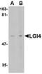 Leucine Rich Repeat LGI Family Member 4 antibody, orb74956, Biorbyt, Western Blot image 