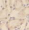 DEAD-Box Helicase 17 antibody, FNab02296, FineTest, Immunohistochemistry paraffin image 